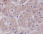 Anti-Glutamine Synthetase GLUL Rabbit Monoclonal Antibody